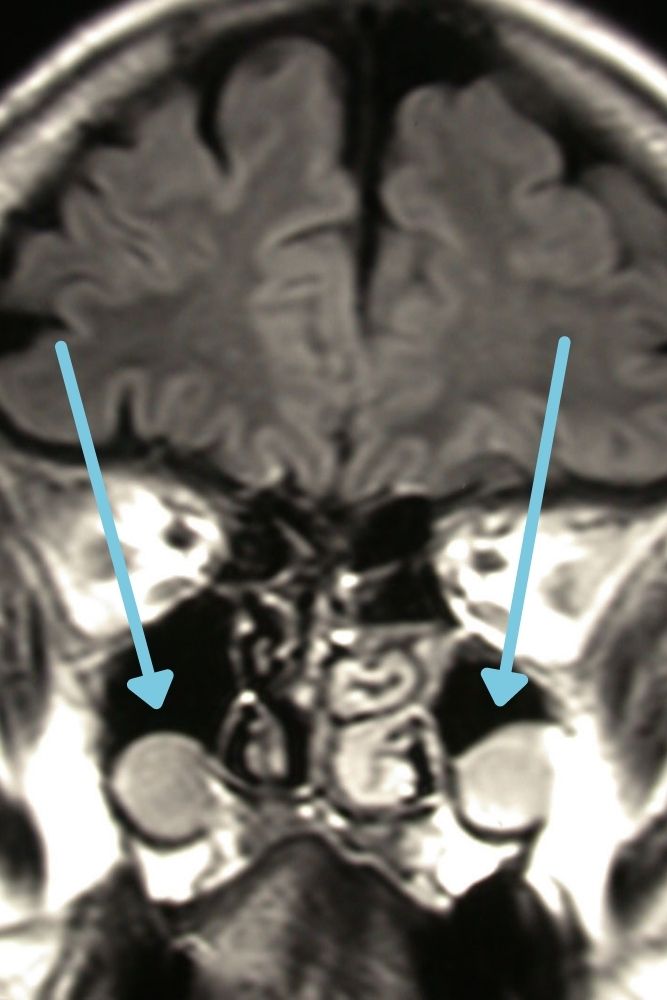 frontalni i maksilarni sinusi beograd centar 4
